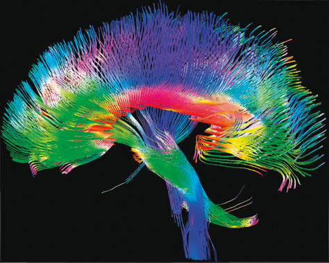 <p>Mapa de alta resolución de conexiones cerebrales obtenido por el <em>Human Connectome Project</em>. P. Hagmann P et al.<em>-</em>PLoS Biol</p>