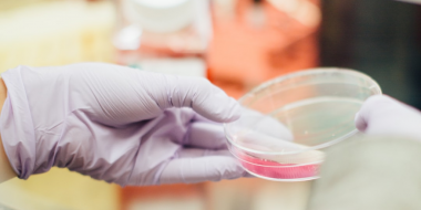 <p>El nuevo sistema patentado por los investigadores granadinos es una prueba de concepto de la potente capacidad antitumoral de la toxina LdrB como sistema de terapia génica contra el cáncer, tanto <em>in vitro</em> como <em>in vivo. / </em>Pablo Buffer</p>
