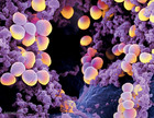 la bacteria Staphylococcus Aureus