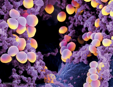 <p><em>Staphylococcus Aureus</em>, una de las bacterias más peligrosas que son capaces de combatir estos dos antibióticos. / IBGM</p>