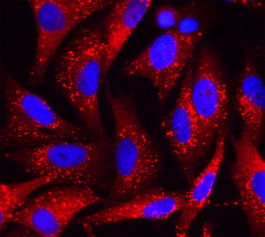 <p>Identificación de nuevos moduladores de metástasis y mal pronóstico en el melanoma: Visualización de la proteína p62 (rojo) mediante microscopía de fluorescencia en células de melanoma. Las estructuras esféricas punteadas corresponden a grandes agregados de p62 con otras proteínas, entre ellas, factores que controlan múltiples procesos implicados en la supervivencia, proliferación e invasión de estas células tumorales. / CNIO</p>