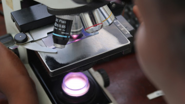 <p>Las dos especies que suelen causar infecciones en el ser humano son <em>Cryptococcus neoformans</em> y <em>Cryptococcus gatti</em>, la cual se describió hace relativamente poco. / ISGlobal</p>