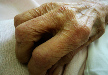 <p>Las investigación podría revolucionar el diagnóstico del alzhéimer. / <a href="http://www.flickr.com/photos/sarchi/266800522/sizes/l/" target="_blank">Sarchi</a></p>