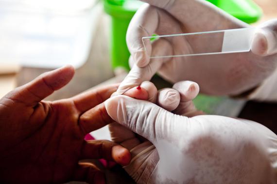 <p>Test para la detección de la malaria. / <a href="https://www.flickr.com/photos/gatesfoundation/6232363827/sizes/l/in/photostream/" target="_blank">Gates Foundation</a></p>
