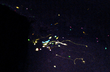 <p>Dispersión clonal de tipos neurales en adulto tras electroporación en ratones recién nacidos con la técnica UbC-StarTrack que permite seguir el linaje celular en el cerebro. / Instituto Cajal / CSIC</p>