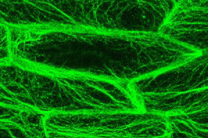 <p>Citoesqueleto de actina (teñido de verde) en las células de la planta <em>Arabidopsis thaliana</em>. Imagen: Antonio Leyva / Michael Sauer.</p>