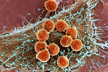 <p>El trabajo periodístico de Méndez sobre nuevas terapias oncológicas basadas en el uso del propio sistema inmunitario ha merecido el premio del Instituto Roche. En la imagen, linfocitos T del sistema inmunitario se unen a una célula tumoral para destruirla. / Memorial Sloan Kettering</p>