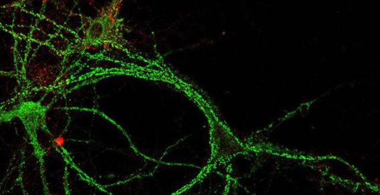 <p>Los científicos elevaron los niveles de colesterol en las neuronas hipocampales viejas y los situaron a los niveles de las neuronas jóvenes. / CSIC. </p>