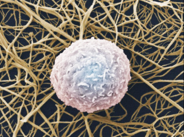 <p>Los leucocitos, también llamados glóbulo blanco, son las células responsables de la respuesta autoinmune. Imagen: Wellcome images.</p>