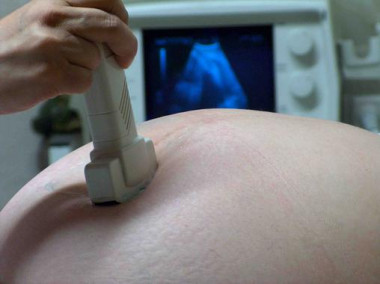 <p>Para  llevar a cabo esta investigación, los expertos realizaron un seguimiento a 44 mujeres durante todo el embarazo y el postparto. / <a href="http://www.sxc.hu/photo/676878" target="_blank">Jeinny Solis</a>.</p>