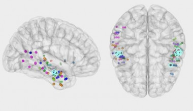 <p>El estudio ha permitido registrar simultáneamente la actividad neurofisiológica del hipocampo y el neocórtex, algo que ningún otro estudio en humanos había logrado antes. / IBEC</p>