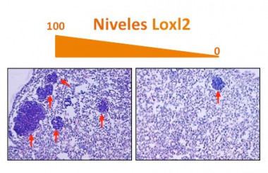 <p>Cortes histológicos de pulmones con metástasis (flechas rojas). Izquierda: metástasis originadas a partir de tumores con niveles normales de Loxl2. Derecha: metástasis producidas a partir de tumores en los que se ha eliminado Loxl2. / UAM</p>