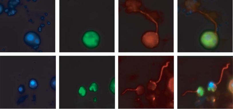 <p>Micrografías que muestran los flagelos en células de <em>cryptomycota</em>. Imagen: Massana/CSIC.</p>