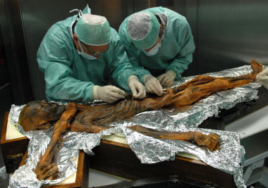 <p>Los análisis del estómago del Hombre de Hielo no se realizaron con anterioridad ya que los científicos no pudieron encontrarlo: este se había desplazado hacia arriba durante el proceso de momificación. / <a href="https://media.eurekalert.org/multimedia_prod/emb/media/174917.jpg" target="_blank">Southtyrolarchaeologymuseum\Eurac\M.Samadelli</a></p>