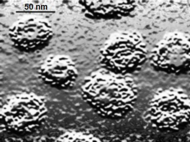 
<!-- START: including template: extension/sinc/design/ezwebin/templates/content/datatype/view/ezxmltags/paragraph.tpl (design:content/datatype/view/ezxmltags/paragraph.tpl) -->
<p>Virus del papiloma humano. Imagen: Wikipedia.</p>
<!-- STOP: including template: extension/sinc/design/ezwebin/templates/content/datatype/view/ezxmltags/paragraph.tpl (design:content/datatype/view/ezxmltags/paragraph.tpl) -->
