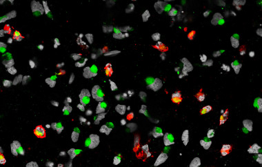 <p>Los investigadores han demostrado en laboratorio que el virus del Zika provoca la muerte celular de las células progenitoras neurales humanas. / Sarah C. Ogden</p>