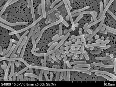 <p>Imagen microscópica de<em> </em>la bacteria <em>Acinetobacter baumannii. / </em>UPV/EHU</p>