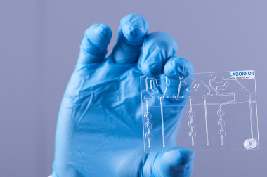 <p>El sistema será capaz de detectar el ADN fetal en pequeñas muestras de sangre materna de forma rápida, no invasiva y con menor coste con técnicas de lab on a chip. / IK4-Ikerlan</p>