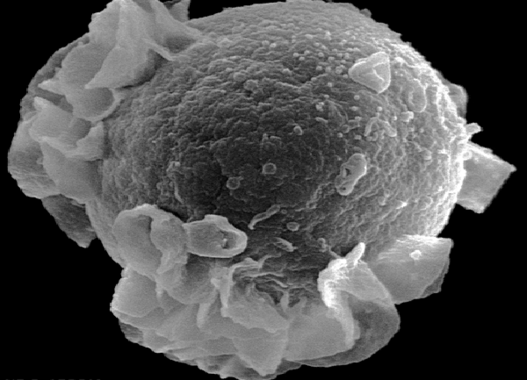 <p>Linfocito B al microscopio electrónico. / <a href="http://upload.wikimedia.org/wikipedia/commons/4/4f/BCelle.gif" target="_blank">Wikipedia</a></p>