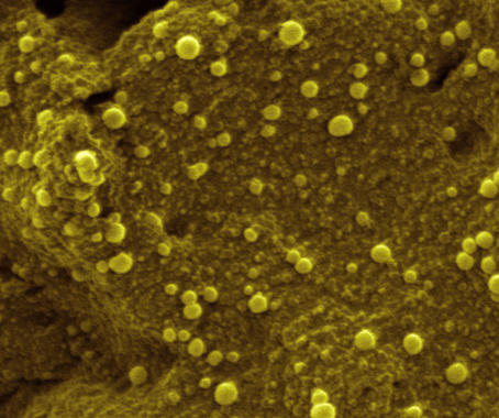 <p>Nanopartículas metálicas depositadas sobre un polímero conductor. Foto: Universidad de Burgos/ DICYT.</p>