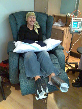 <p>El 8% de las personas en edad adulta desarrollan un segundo cáncer como consecuencia de un tratamiento con radioterapia. Foto: Wikipedia</p>