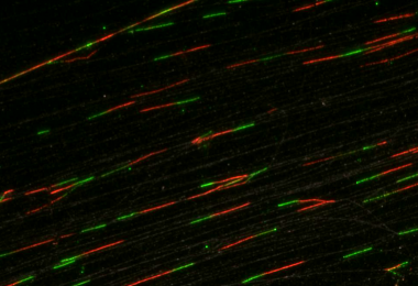 <p>Fibras de ADN en proceso de replicación. / CNIO</p>