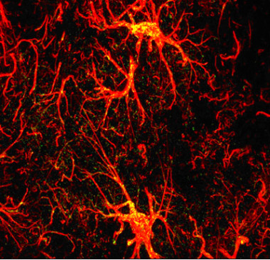 
<!-- START: including template: extension/sinc/design/ezwebin/templates/content/datatype/view/ezxmltags/paragraph.tpl (design:content/datatype/view/ezxmltags/paragraph.tpl) -->
<p>Imágenes del receptor CB2 (en amarillo) en las células gliales (en rojo)</p>
<!-- STOP: including template: extension/sinc/design/ezwebin/templates/content/datatype/view/ezxmltags/paragraph.tpl (design:content/datatype/view/ezxmltags/paragraph.tpl) -->
