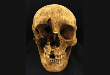 <p>Calavera de uno de los esqueletos hallados en el cementerio romano de Casal Bertone. / Kristina Killgrove</p>