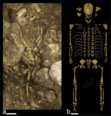 <p>Esqueleto del niño Calcolítico del Portalón durante la excavación (a) y una vez restaurado en el laboratorio (b). Se trata de un individuo infantil que, pese a su corta vida (se estima que murió en torno a los 7 años), padeció varias crisis nutricionales por déficit de vitaminas. / Laboratorio de Evolución Humana de la Universidad de Burgos. </p>