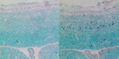 <p>La falta de CEP63 incrementa la muerte de células madre en un cerebro de ratón en desarrollo. La imagen de la derecha muestra en violeta células madre en muerte celular. Los ratones nacen con microcefalia, característica del síndrome de Seckel. / Berta Terré, IRB Barcelona</p>