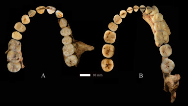 <p>Dentición superior (izquierda) e inferior (derecha) de Dushan 1/ Wei Liao. / CENIEH</p>