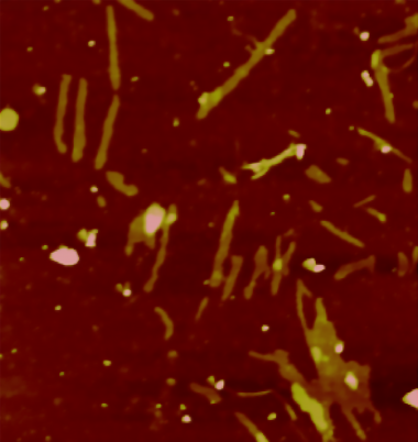 <p>Los agregados de la proteína Receptor de Andrógenos (en la imagen) dañan las células musculares y neuronas motoras en la enfermedad de Kennedy. / B. Eftekharzadeh, IRB Barcelona</p>