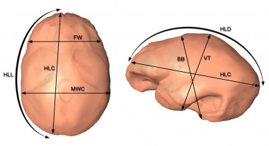<p>Análisis de uno de los cráneos de Homo erectus. / Bruner et al.</p>