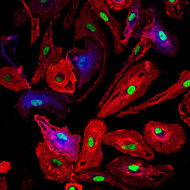 <p><a href="http://plataformasinc.es/index.php/esl/Galeria-multimedia/Imagenes/Celulas-de-microglia-a-las-que-se-ha-inducido-un-dano-celular" target="_self">Figura</a>: cultivos primarios de células de microglia (rojo) a las que se ha inducido un daño celular, sobreexpresando C/EBPβ (verde) y un agente proinflamatorio (azul).</p>