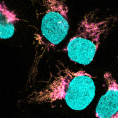 <p>La microscopía confocal muestra la colocalización de EXD2 (magenta) con el ribosoma mitocondrial (amarillo). El ADN se tiñe para definir el núcleo (cian). / Travis Stracker, IRB Barcelona</p>