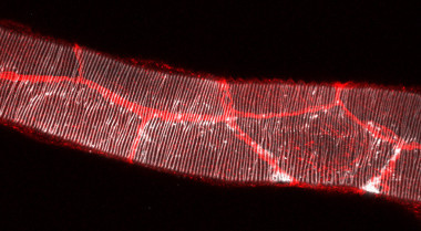 <p>Imagen del tubo traqueal larvario principal, en blanco la matriz extracelular de quitina y en rojo las uniones célula-célula / IRB Barcelona</p>