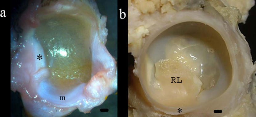 <p>a) Acetábulo de anfibio (Xenopus). Se observa la existencia de una estructura similar al ligamento transverso (*), al igual que la presencia de un menisco (m) en el isquion.</p><p>b) Acetábulo humano (33 semanas). Ligamento transverso (*) y ligamento redondo (RL)</p>