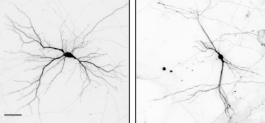 <p>Las imágenes muestran neuronas preparadas a partir de cerebros de ratones de control (izquierda) y ratones sin el gen Nek7. Las dendritas son más cortas y están menos ramificadas en las neuronas de ratones sin NEK7./ IRB Barcelona</p>