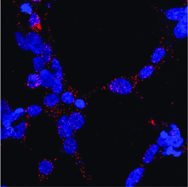 <p>Interacción en las células entre el receptor de andrógenos y la chaperona Hsp70 (en rojo). En azul se muestran los núcleos de las células / Xavier Salvatella, IRB Barcelona</p>