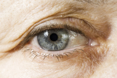 <p>Los ojos, de naturaleza <em>inmunoprivilegiada</em>, han sido los primeros en beneficiarse de esta tecnología / Fotolia</p>