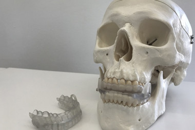 <p>Dispositivo bucal que previene la apnea del sueño fabricado a medida con impresora 3D. / UMA</p>