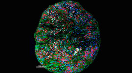 Imagen de microscopía multicolor de los componentes del sistema inmunitario tras el tratamiento de inmunoterapia