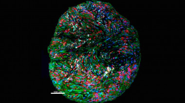 <p>Imagen de microscopía multicolor de los componentes del sistema inmunitario tras el tratamiento de inmunoterapia (células tumorales, en verde; células mieloides, en rojo; y células linfocitarias, en blanco. / Cima Universidad de Navarra</p>