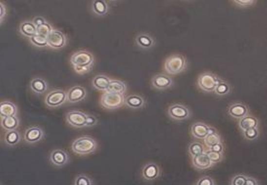 <p>Levadura BM60, la Saccharomyces cerevisiae. Foto: CSIC.</p>