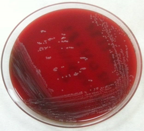 <p>Cultivo en placa de <em>Dermabacter hominis</em>. / Foto cedida a DiCYT por Isabel Fernández Natal.</p>