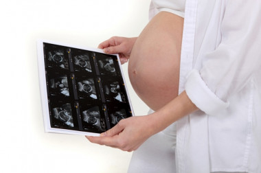 <p>La muestra ha estado compuesta por 285 gestantes voluntarias. / URJC</p>