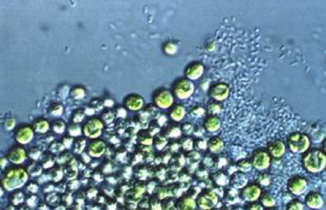 La Biotecnologia De Microalgas Eficaz Para El Tratamiento De