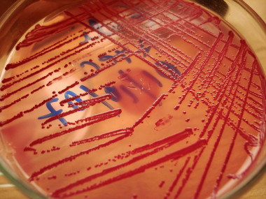 <p>Cultivo de <em>E. Coli</em>. Foto: Carlos Rosas</p>