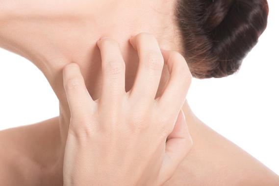 <p>Las células GRPR son las encargadas de transmitir la sensación de picazón al cerebro. /Fotolia</p>