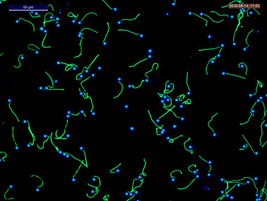 <p> Imagen tomada con un microscopio de fluorescencia: el color azul detecta el material genético (ADN) y el verde marca la cola del espermatozoide / UA</p>